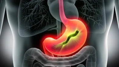Helicobacter pylori dans l estomac