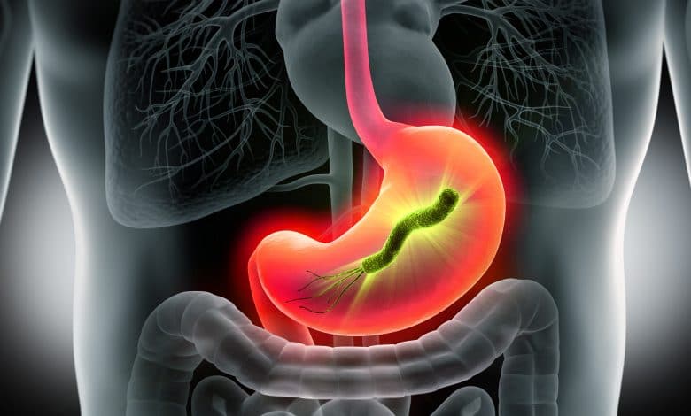 Helicobacter pylori dans l estomac