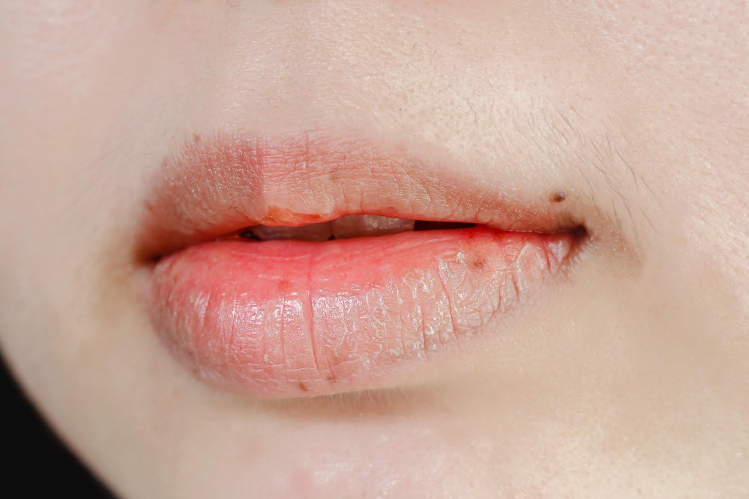 J'ai souvent la bouche sèche. Que puis-je faire pour soulager ce problème