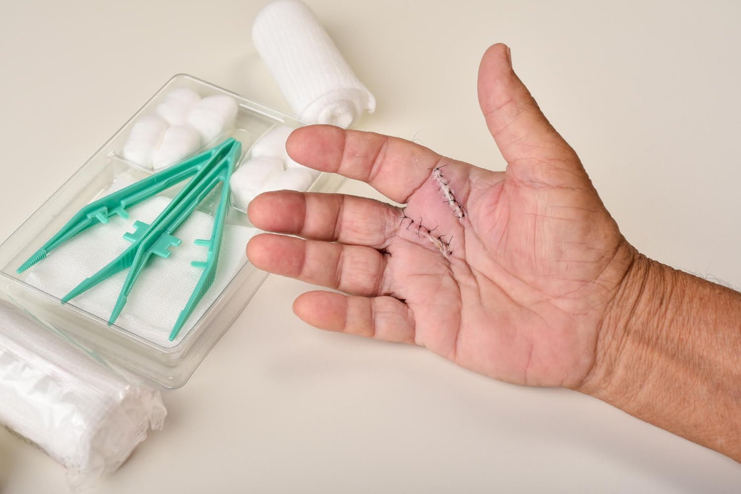 Pourquoi avezvous la peau des doigts qui pèle