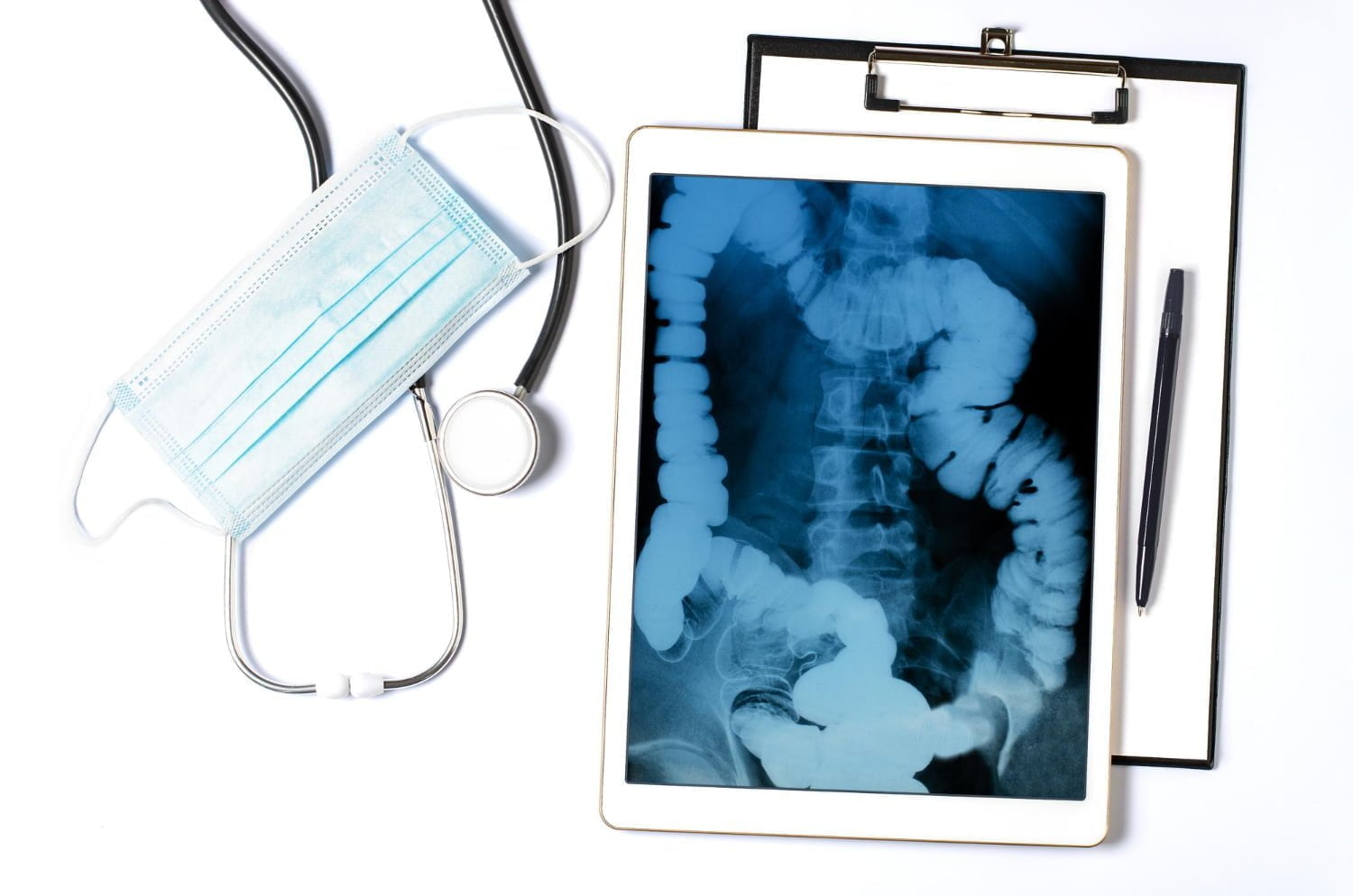 The first signs and symptoms of colon cancer and what to do archyde