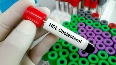 Eprouvette test cholesterol